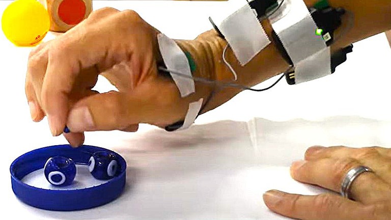 Eine Verletzung des Rückenmarks führt zu Lähmungen. Ein neues Gerät zur Elektrostimulation soll Gelähmten ohne Operation helfen. Studien zeigen Erfolge bei Arm- und Handbewegungen.